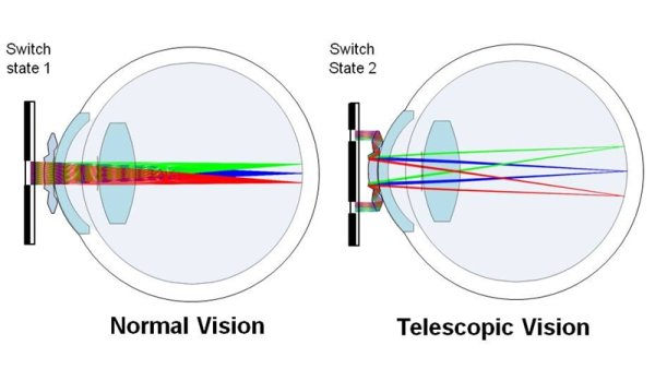 Zoomable Contact Lens (4)