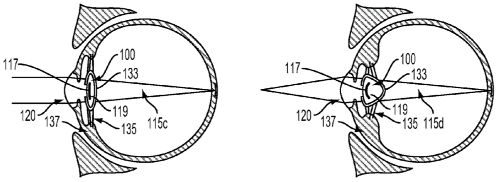 artificial-lens