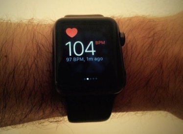 พี่ไม่ได้มาเล่นๆ! Apple วางแผนอัพเลเวลให้ Apple Watch วินิจฉัยโรคได้เอง