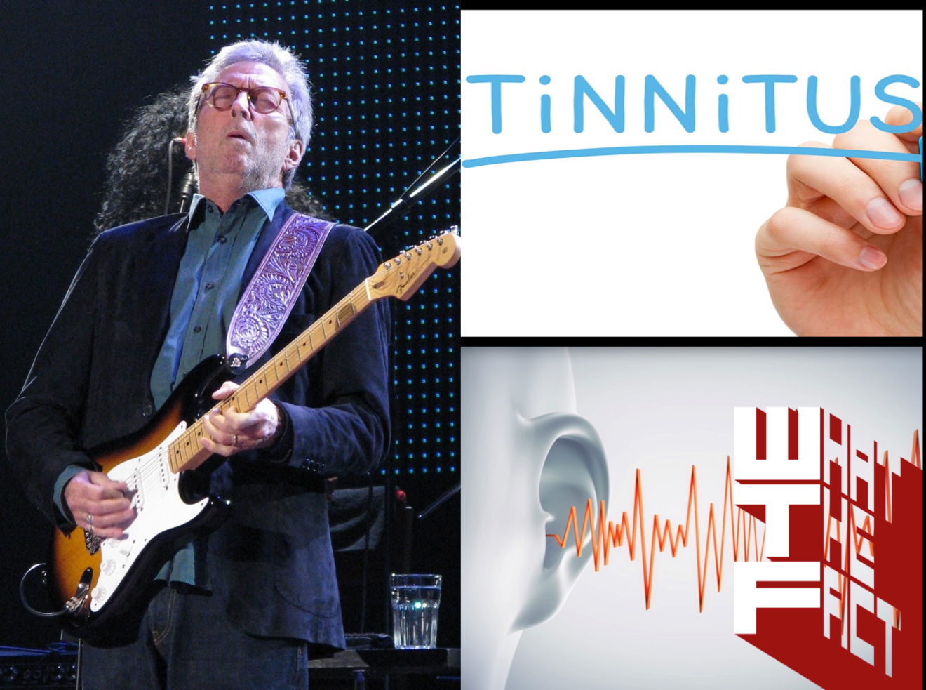 โรคเสียงในหู (Tinnitus) อันตรายของคนดนตรี และ 10 ศิลปินที่เป็นโรคนี้