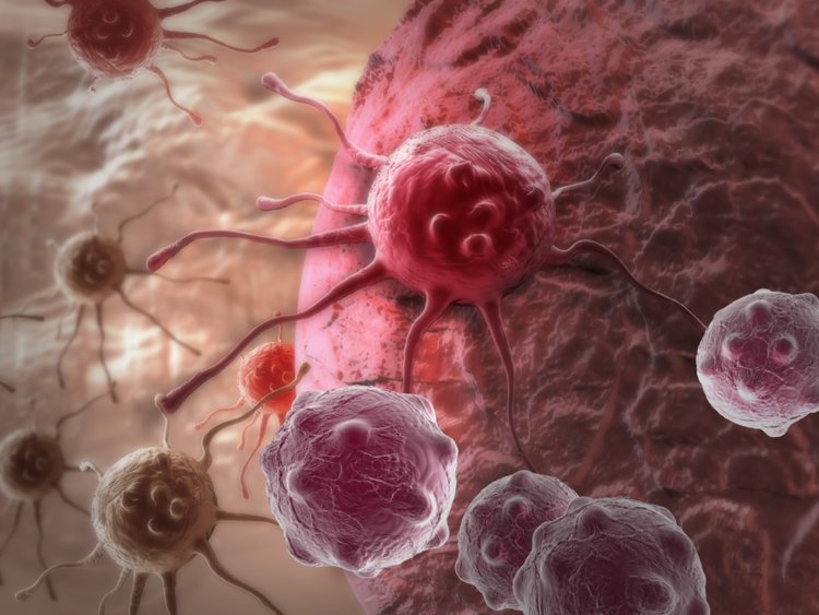 ไม่ต้องทำ Chemo ก็อาจรักษามะเร็งได้! นักวิทยาศาสตร์พบวิธีการรักษามะเร็งโดยใช้อาวุธลับที่อยู่ในเซลล์ของเราแล้ว!