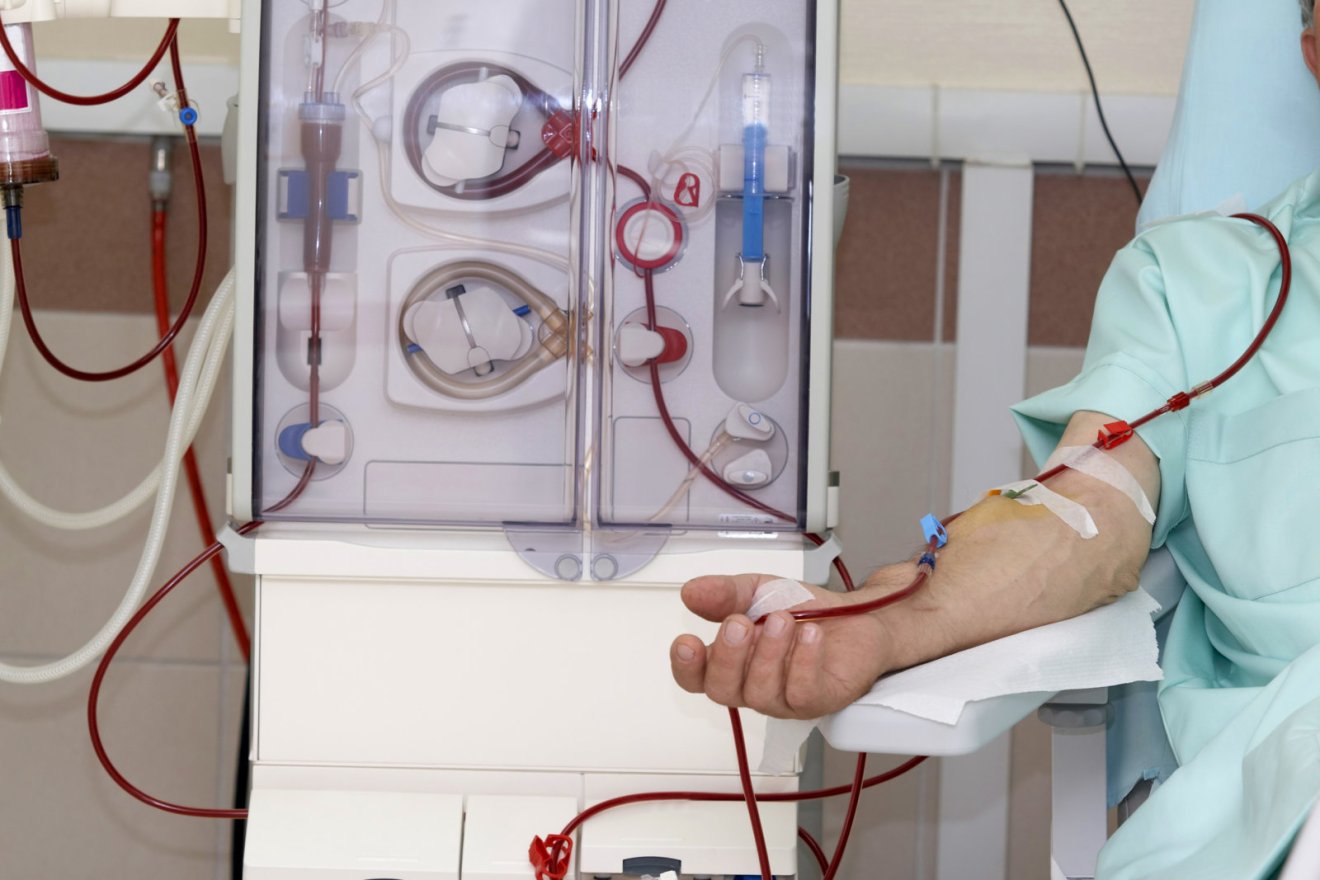 patient at haemodialysis