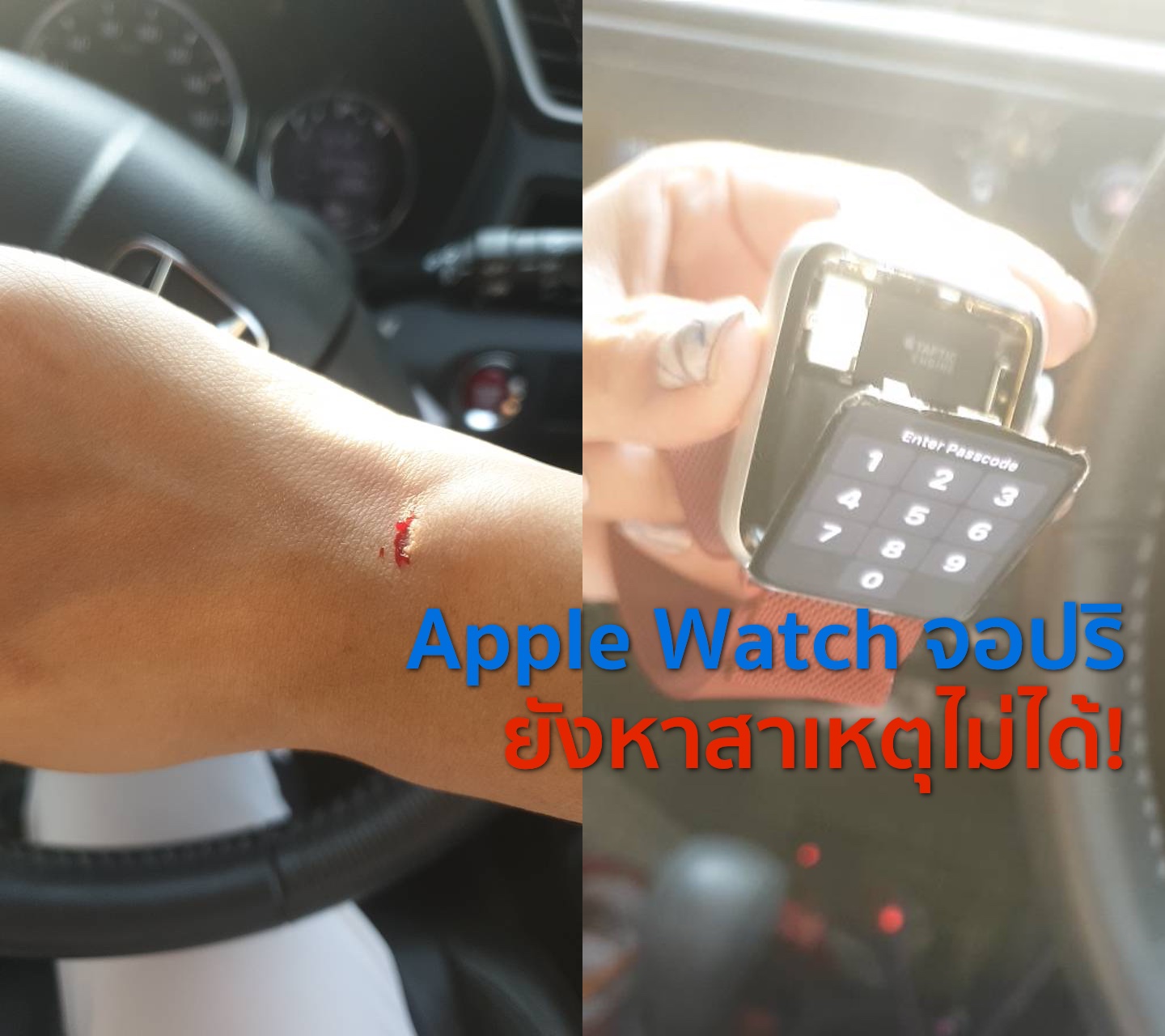 เกิดเหตุ Apple Watch จอปริจนบาดแขนในไทย ด้าน Apple ยังหาสาเหตุที่แน่ชัดไม่ได้