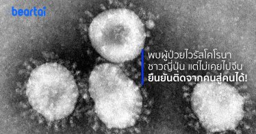 พบผู้ป่วยญี่ปุ่นติดเชื้อไวรัสโคโรนา แต่ไม่เคยไปจีน ยืนยันไวรัสติดจากคนสู่คนได้!