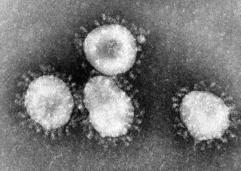 วิจัยชี้! เชื้อไวรัสโคโรนาอยู่บนสิ่งของต่าง ๆ ได้นานสูงสุด 9 วัน
