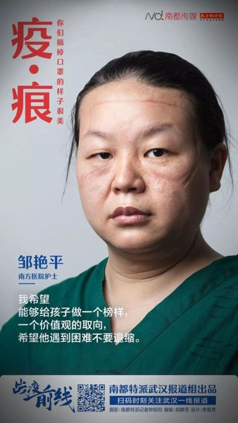 โจวเยี่ยนผิง พยาบาลวิชาชีพ โรงพยาบาล Nanfang 