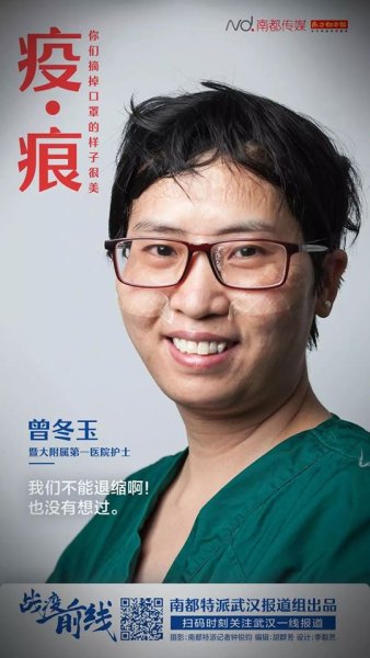เจิงตงยี่ว์ พยาบาลวิชาชีพ โรงพยาบาลในเครือของมหาวิทยาลัย Jinan