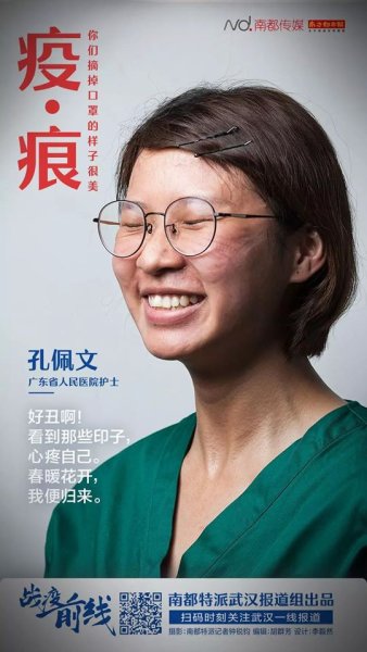 ข่งเพ่ยเหวิน พยาบาลวิชาชีพ โรงพยาบาลกลาง Guangdong