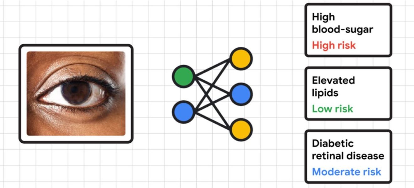 Google วิจัยร่วมกับไทย สร้าง AI ตรวจเบาหวานขึ้นตาด้วยกล้อง พร้อม AI สุขภาพอีกหลายตัว