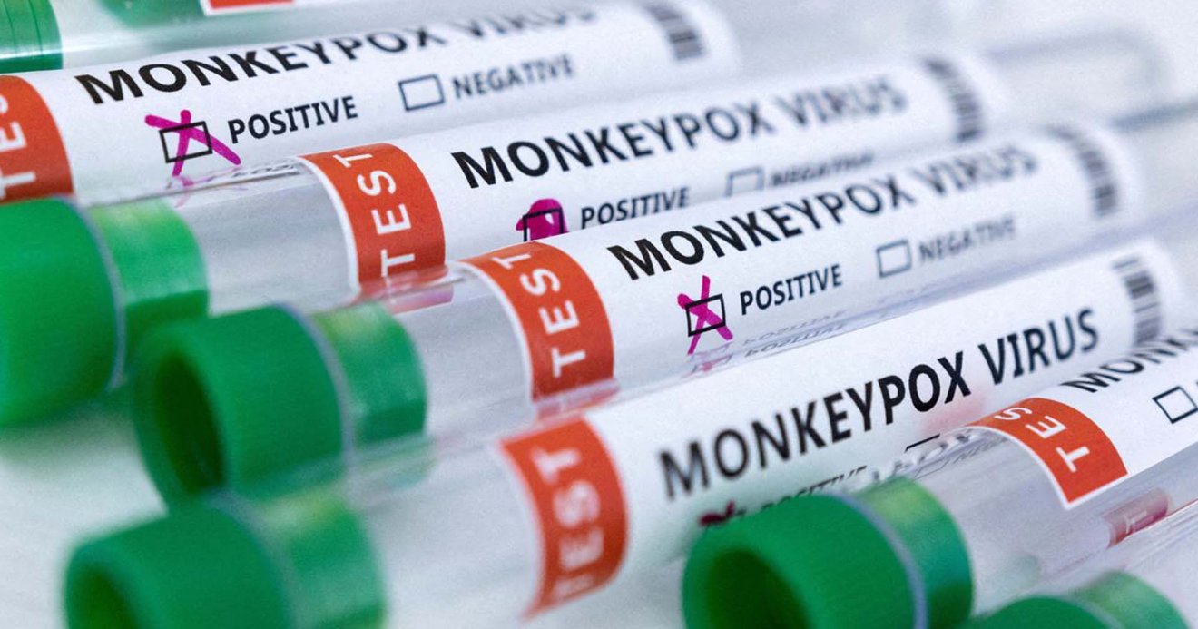 Thailand confirms first monkeypox