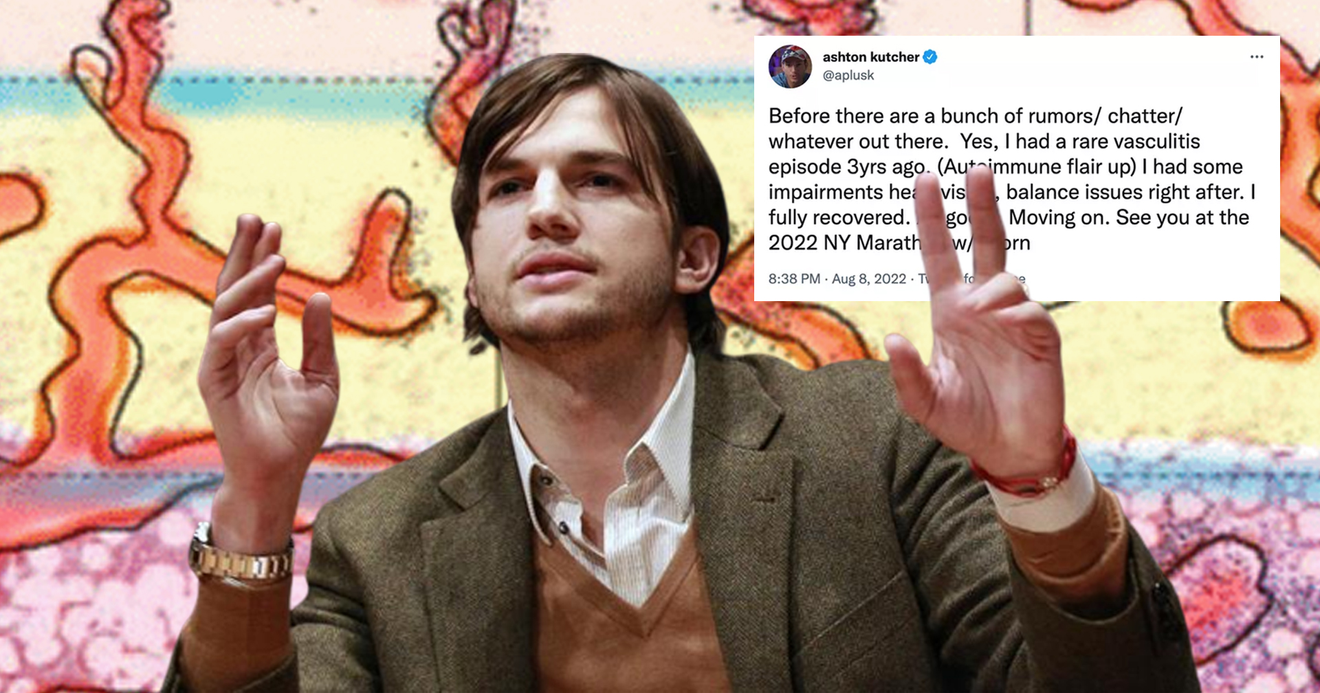 Ashton Kutcher เผยเมื่อ 3 ปีก่อน เคยเป็นโรคหลอดเลือดอักเสบ จนตาเกือบบอด