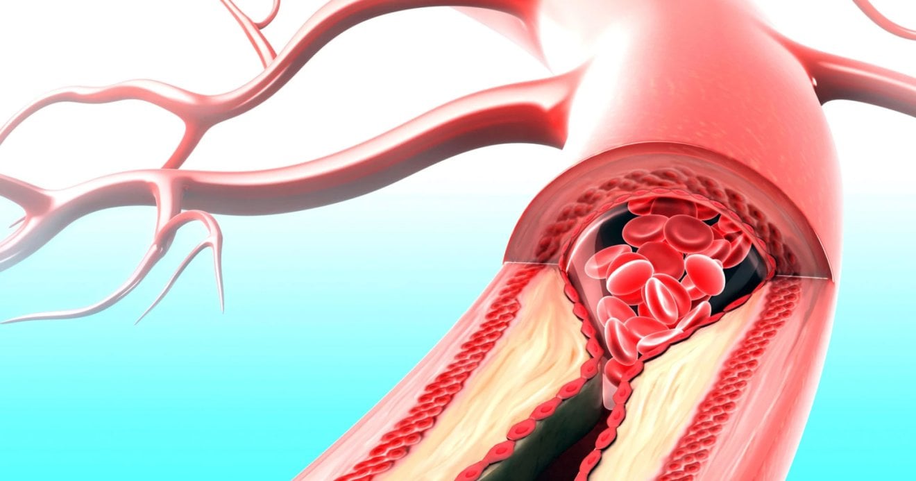 นักวิทย์ฯ พบ “ยาต้นแบบ IC7Fc” สู้โรคเรื้อรังทั้งหัวใจ และเบาหวาน รักษาได้ 2 โรคในตัวเดียว