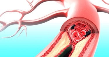 นักวิทย์ฯ พบ “ยาต้นแบบ IC7Fc” สู้โรคเรื้อรังทั้งหัวใจ และเบาหวาน รักษาได้ 2 โรคในตัวเดียว